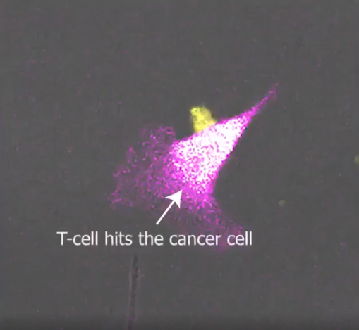 T Cell Attacks Cancer Cell